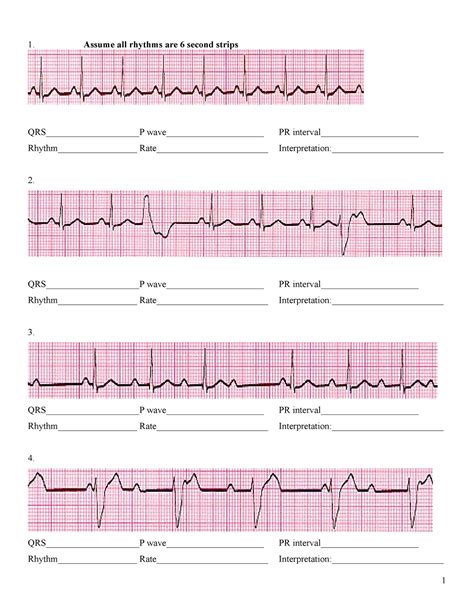 ecg interpretation practice strips